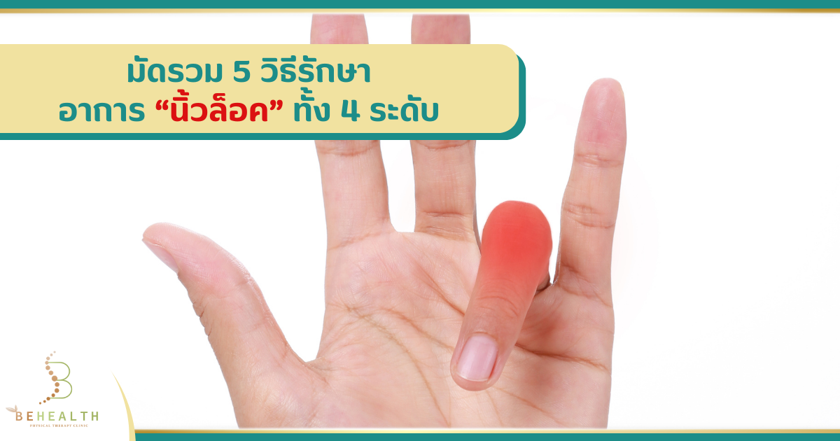 มัดรวม 5 วิธีรักษาอาการ “นิ้วล็อค” ทั้ง 4 ระดับ